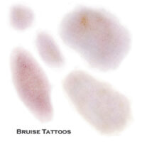 Tatoo-Bruises
